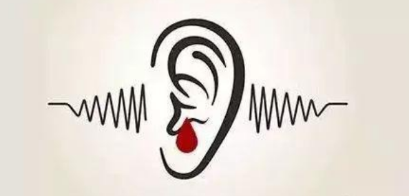 优质护理对突发性耳聋伴耳鸣患者焦虑的缓解作用